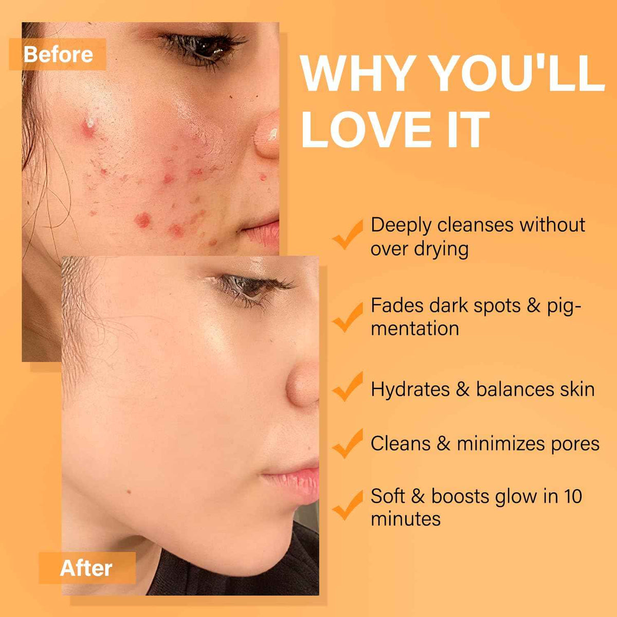 Facial Clay Mask Set - Vitamin C Turmeric Face Mask, Dead Sea Mud & Salicylic Acid (BHA) Mask for Pore Cleansing, Brightening, Blackheads & Dark Spots, Face Masks Skincare