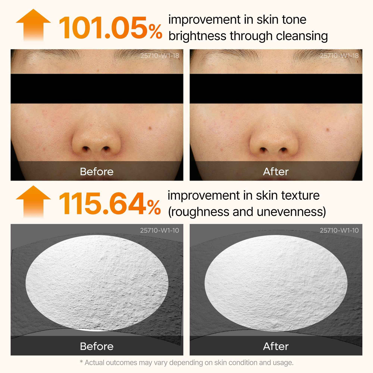 Dr. Melaxin Peel Shot Kojic Acid Turmeric Serum – Exfoliating Dark Spot Corrector with AHA/BHA & Niacinamide, Brightening & Even Tone